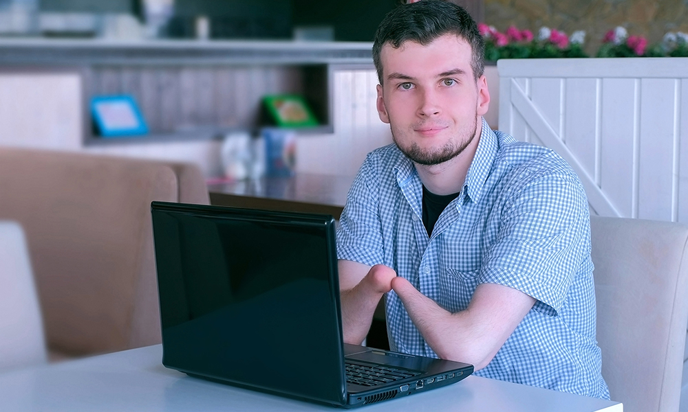 A young adult man with a limb difference on both arms sits in a bright cafe with a laptop. He is looking directly at the camera with a small smile.